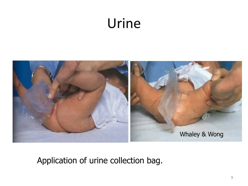 urine