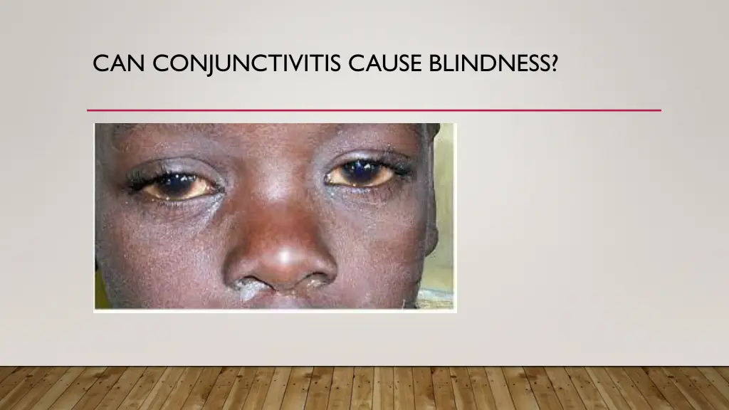 can conjunctivitis cause blindness