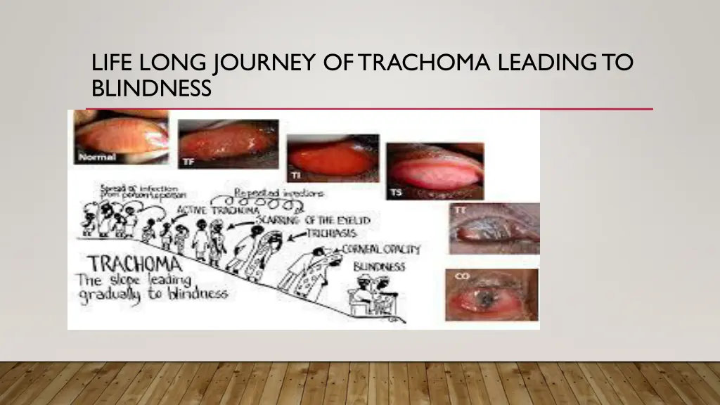 life long journey of trachoma leading to blindness