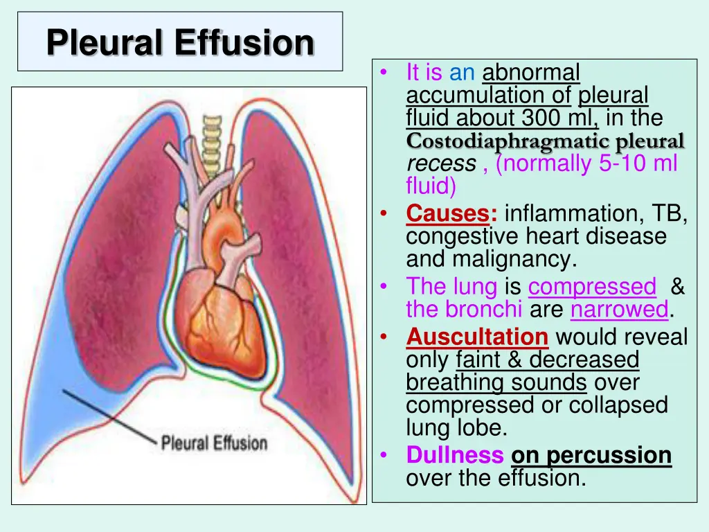 pleural effusion