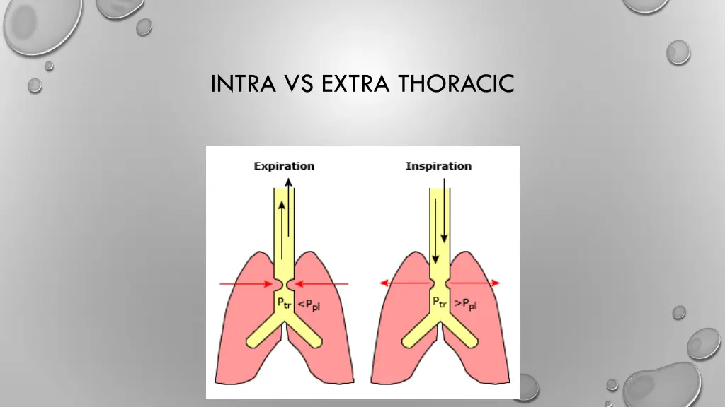 intra vs extra thoracic