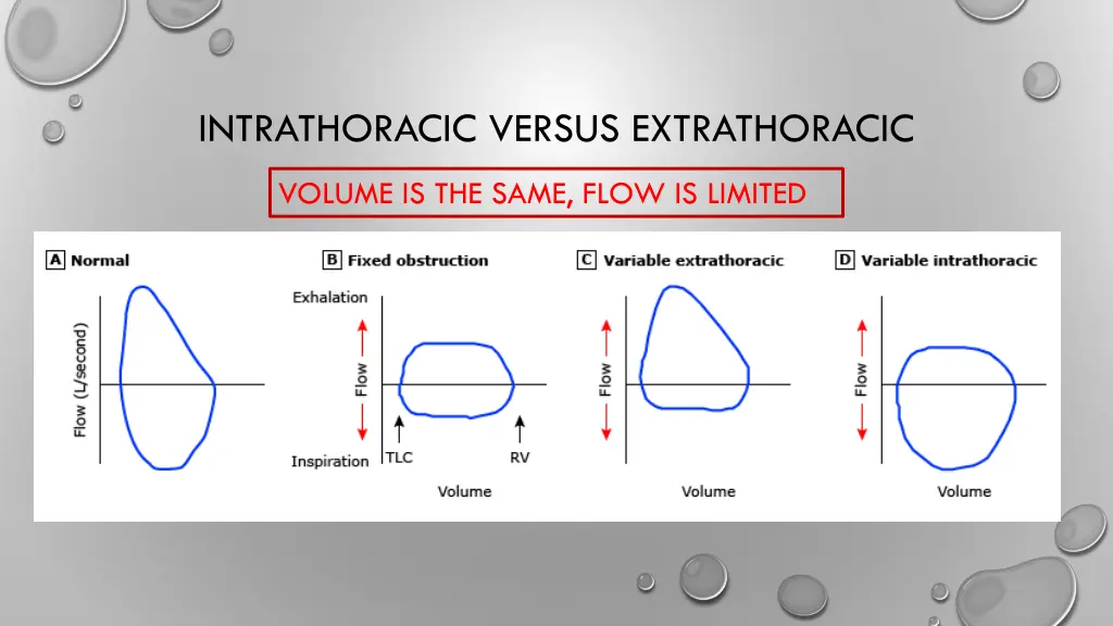 intrathoracic versus extrathoracic