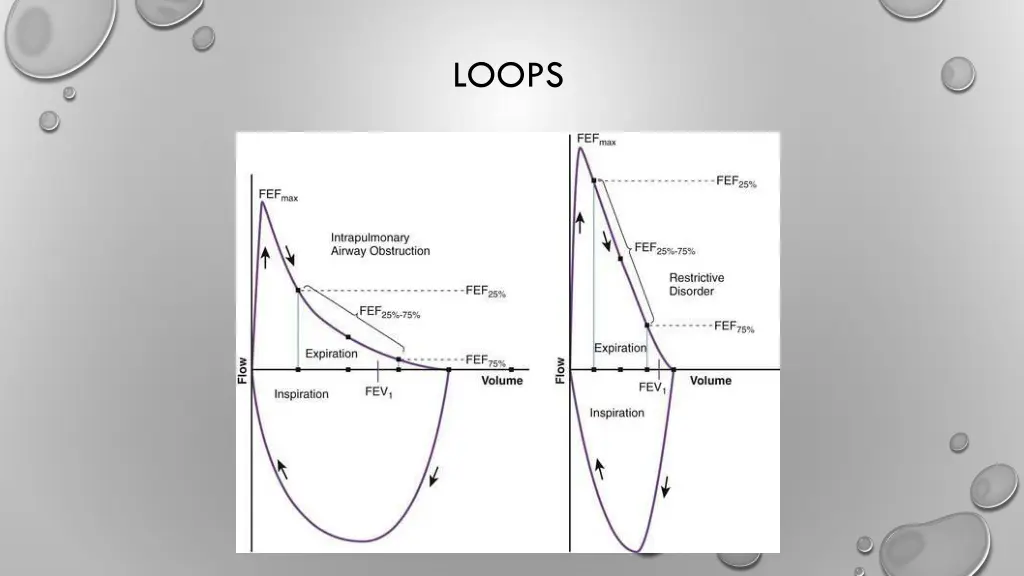 loops