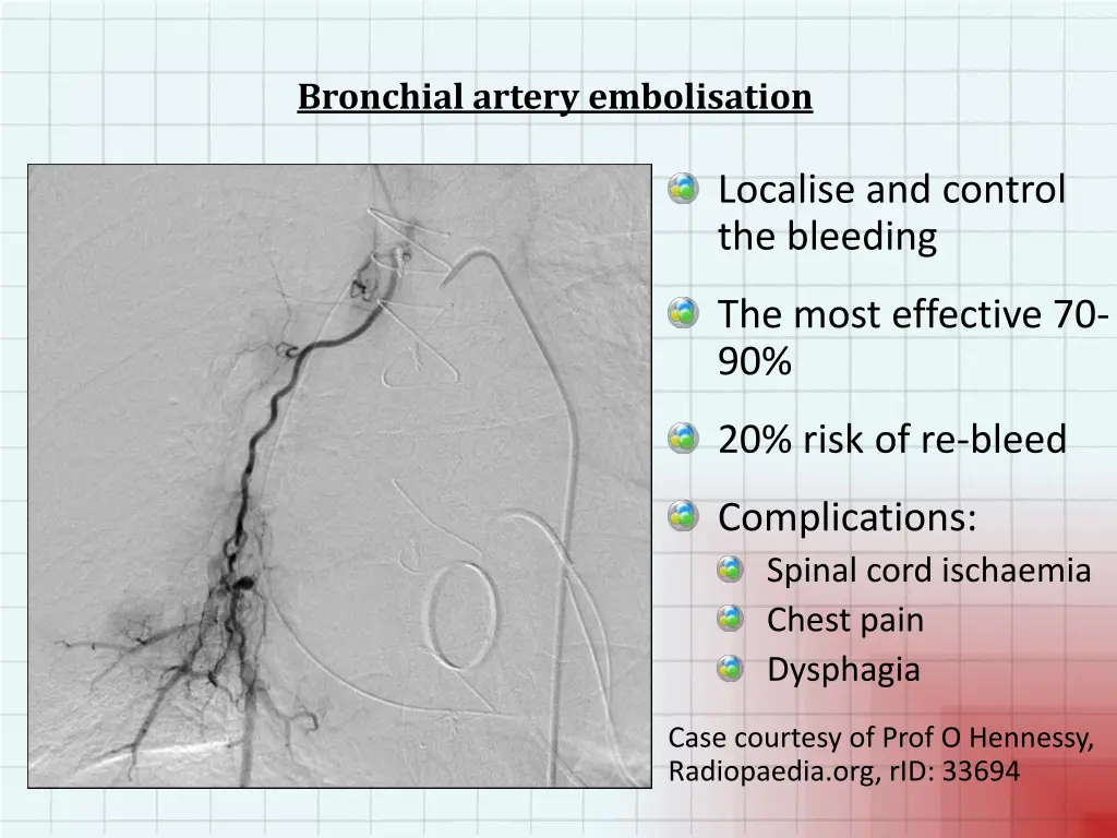 bronchial artery embolisation