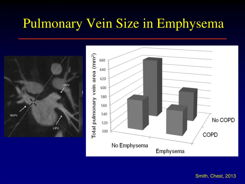 pulmonary vein size in emphysema