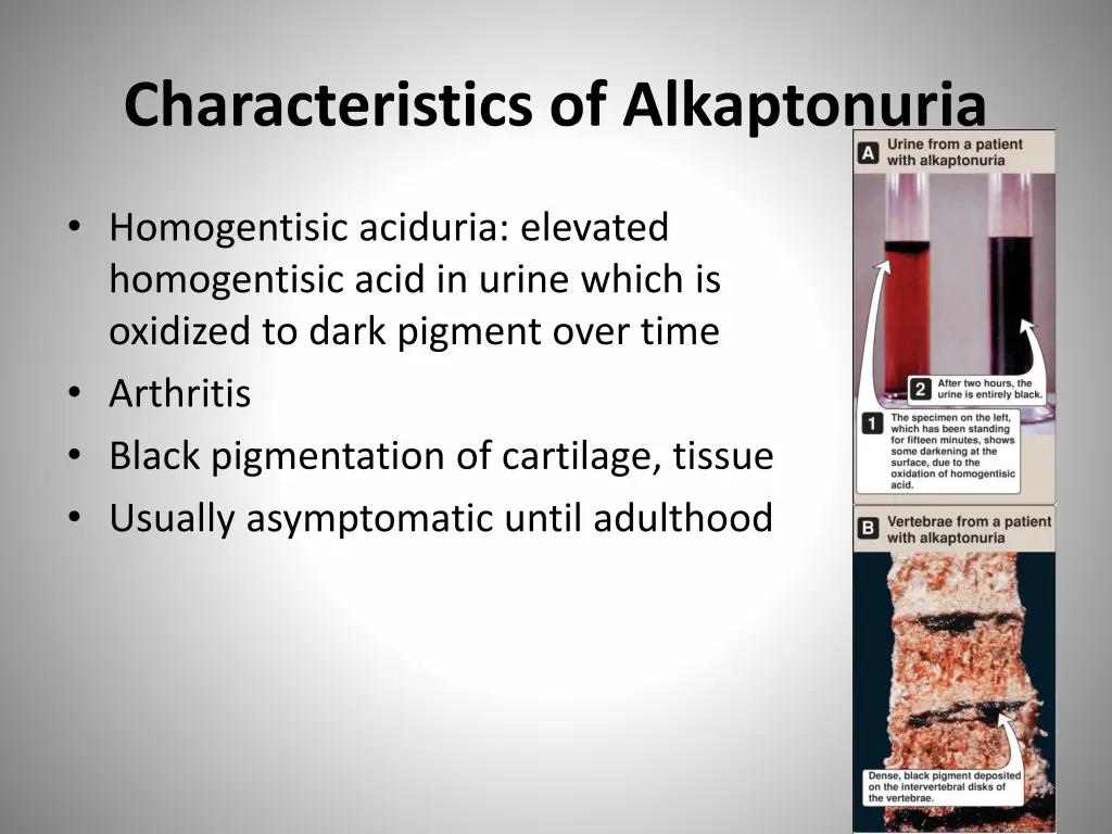 characteristics of alkaptonuria