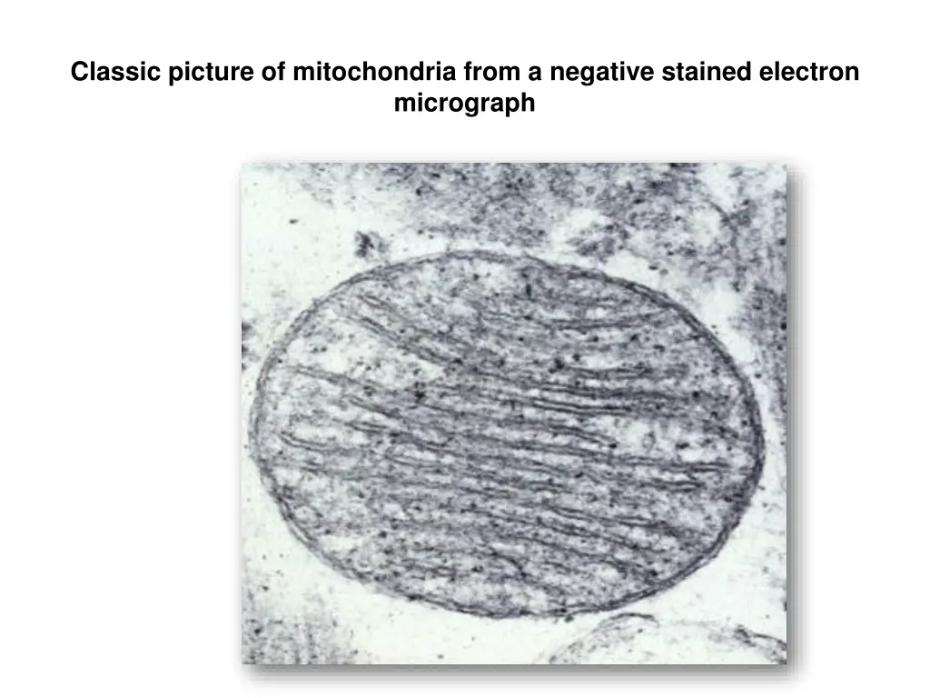 classic picture of mitochondria from a negative