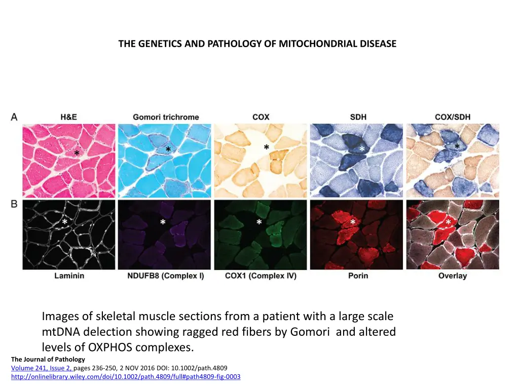 the genetics and pathology of mitochondrial