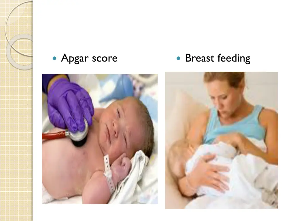 apgar score