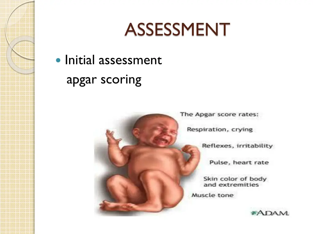 assessment