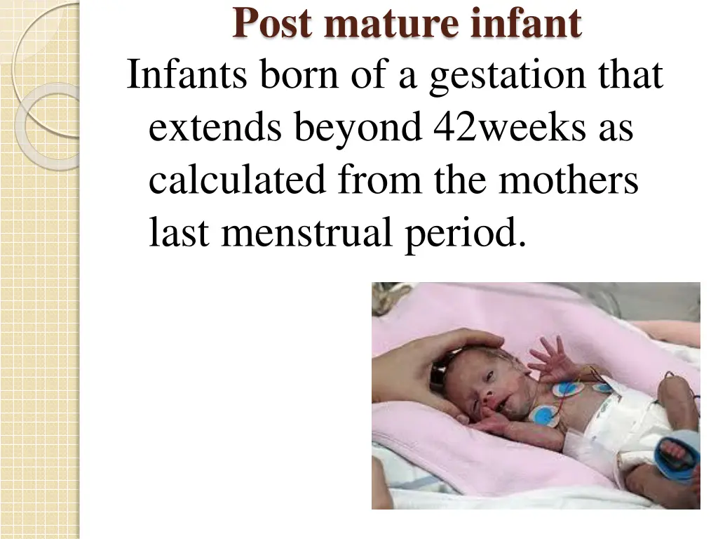 post mature infant infants born of a gestation