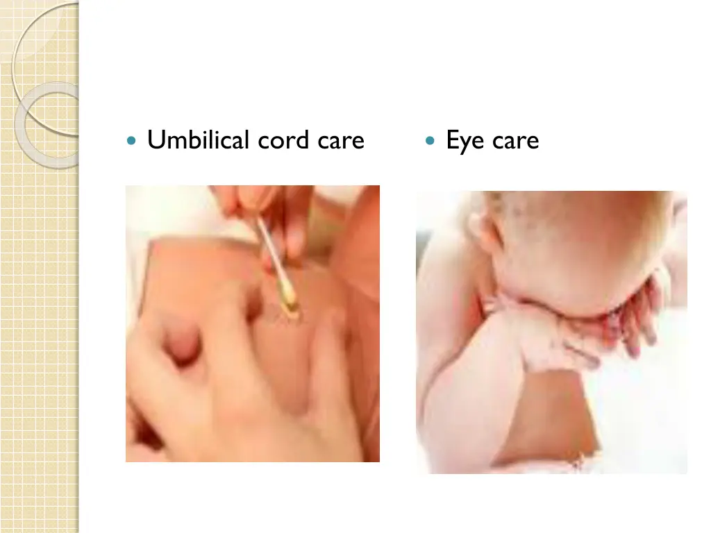 umbilical cord care