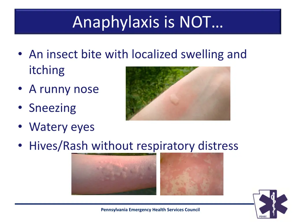 anaphylaxis is not