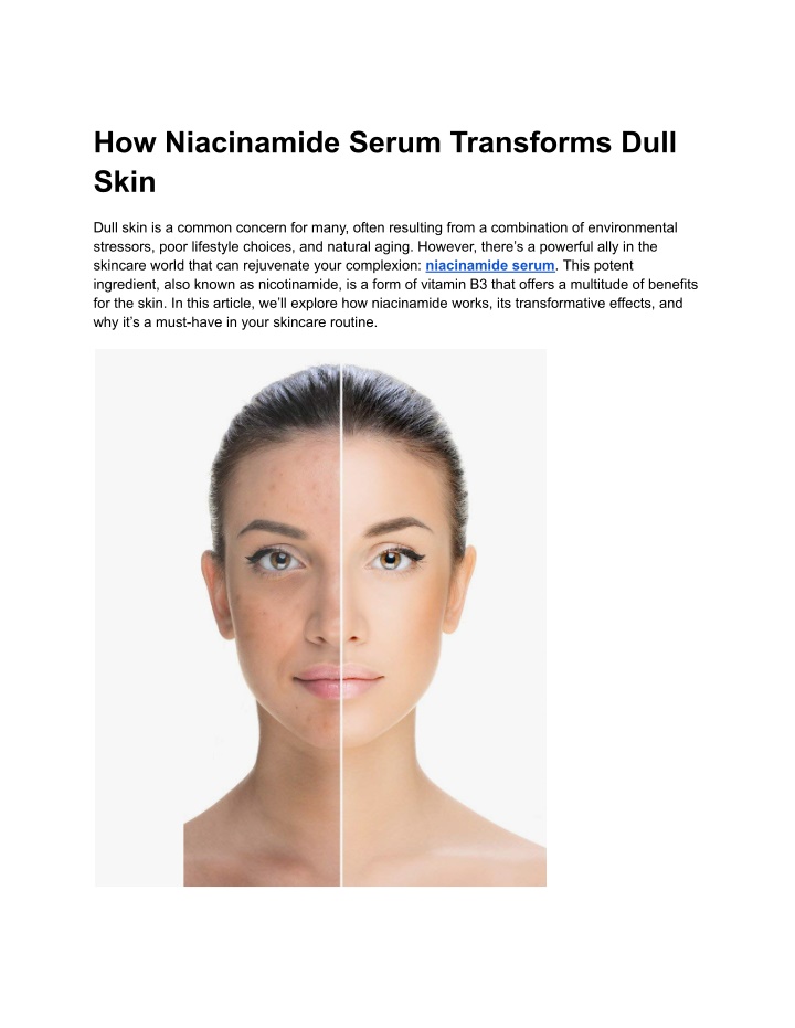 how niacinamide serum transforms dull skin