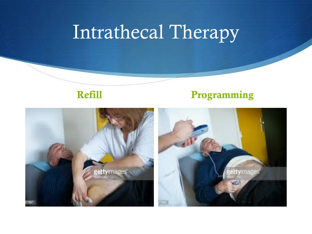 intrathecal therapy