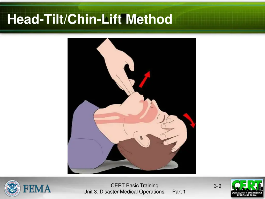 head tilt chin lift method