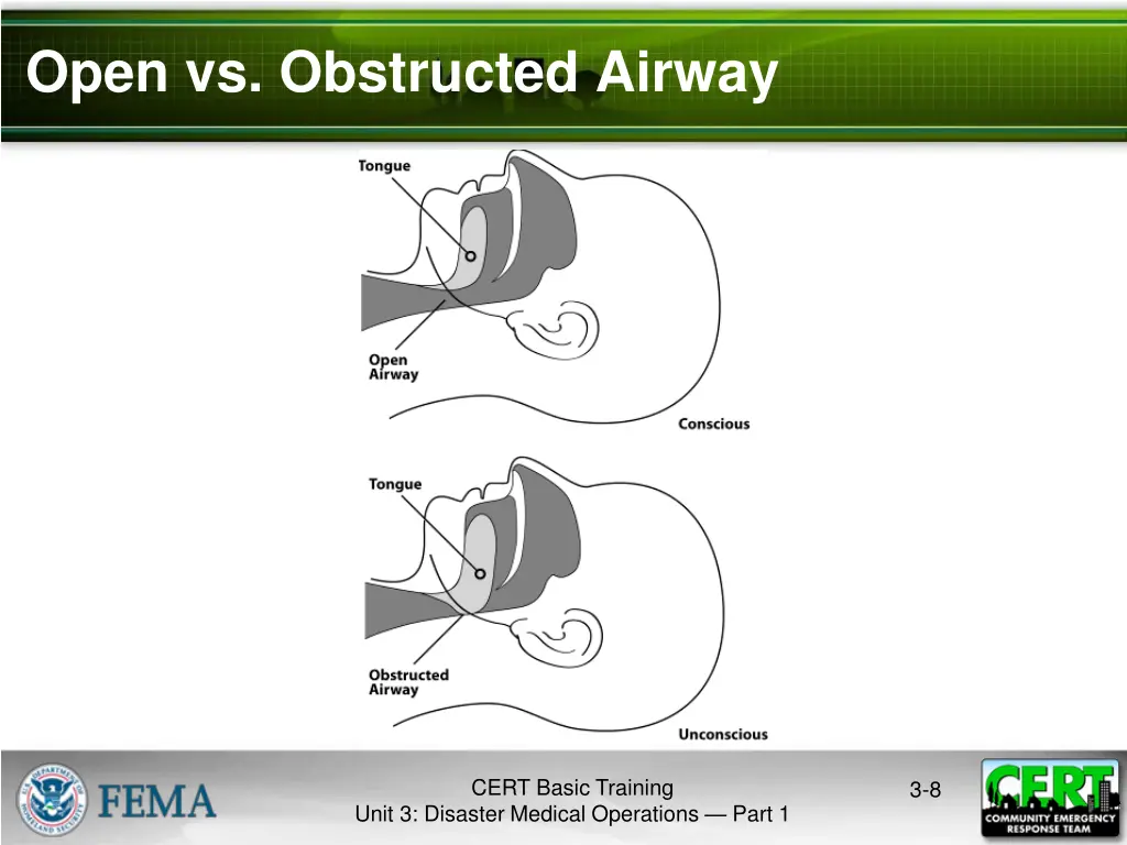 open vs obstructed airway