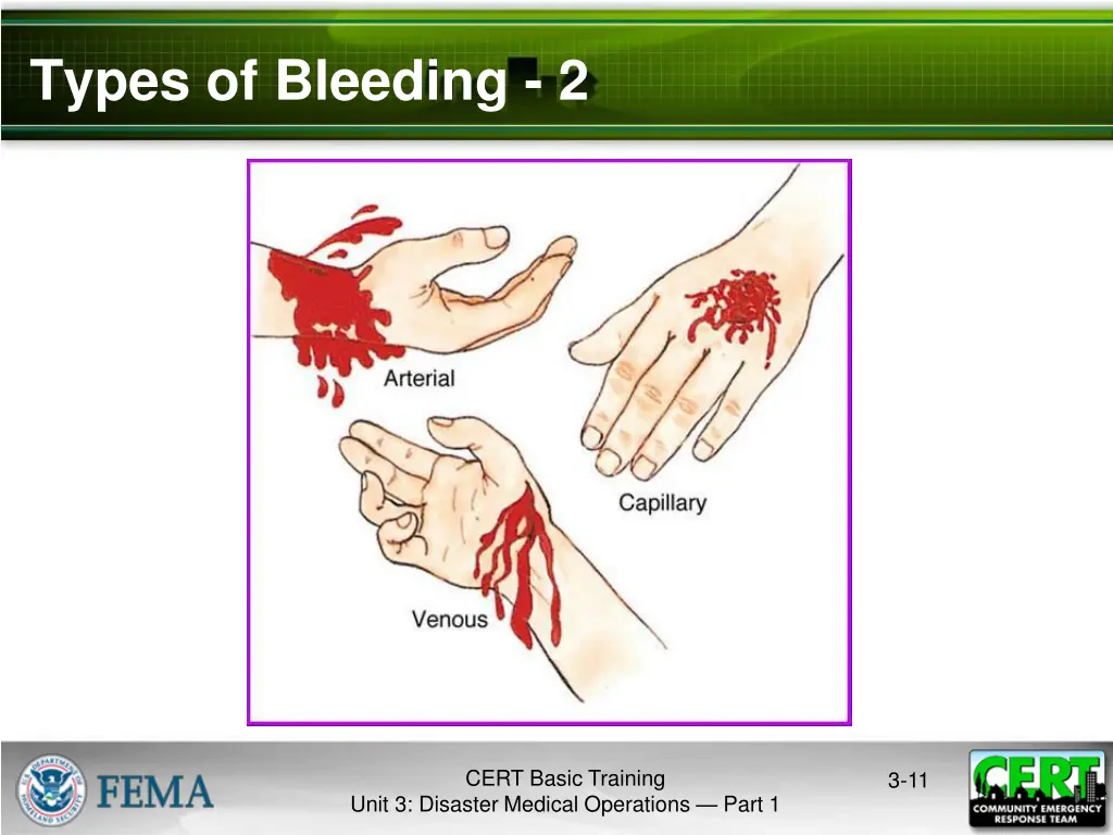 types of bleeding 2