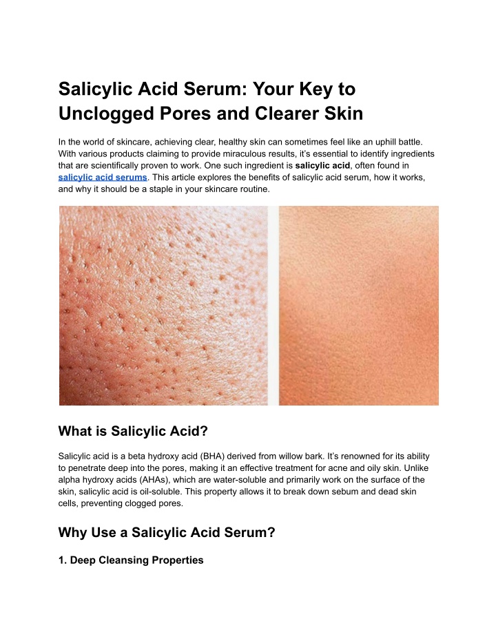 salicylic acid serum your key to unclogged pores