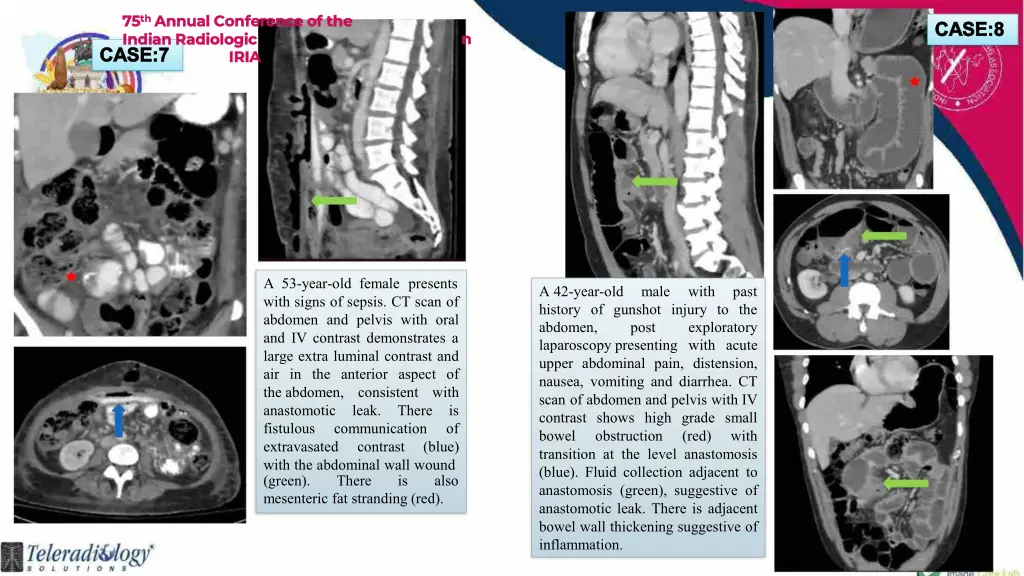 75 75 th indian radiologic indian radiologic case