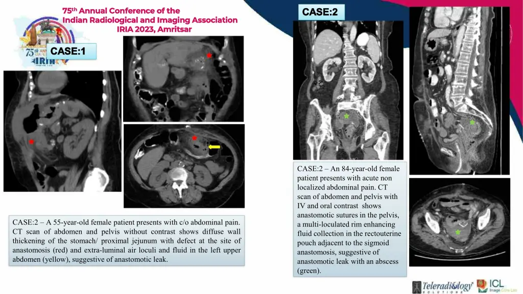 75 75 th indian radiological and imaging 2