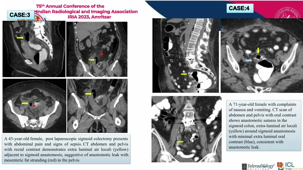 75 75 th indian radiological and imaging 3