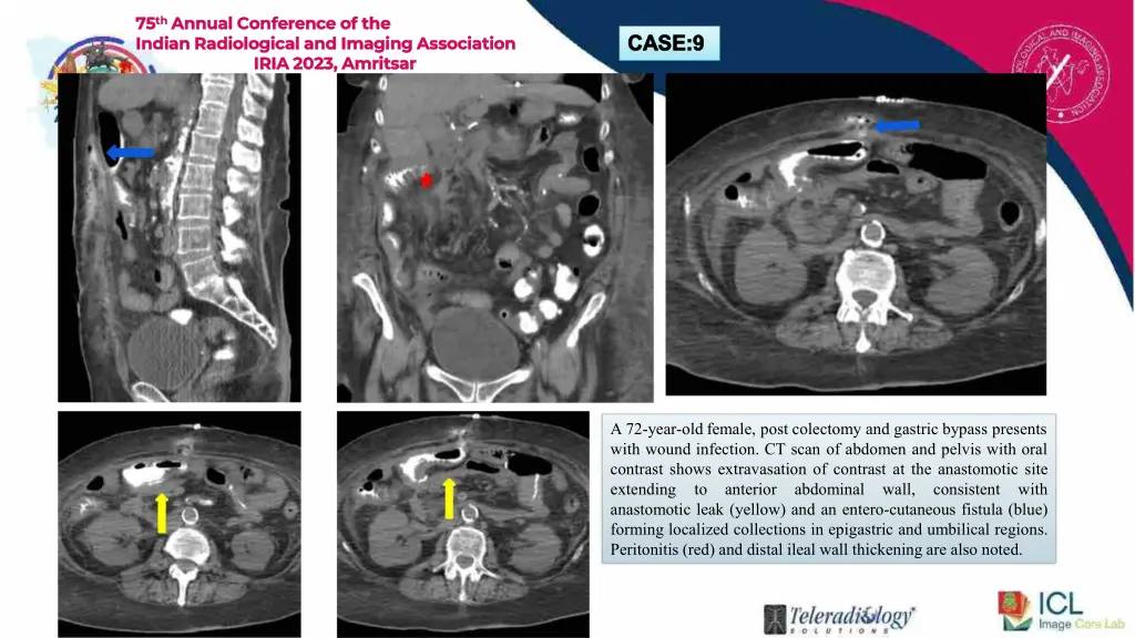 75 75 th indian radiological and imaging 4