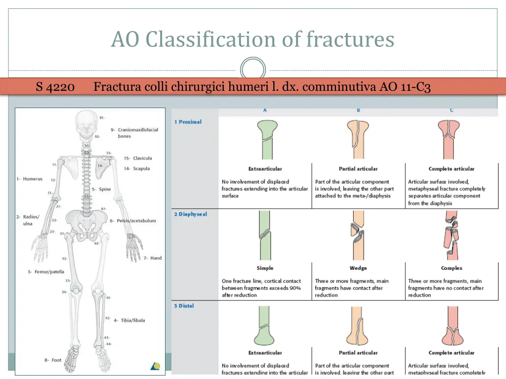 ao classification of fractures