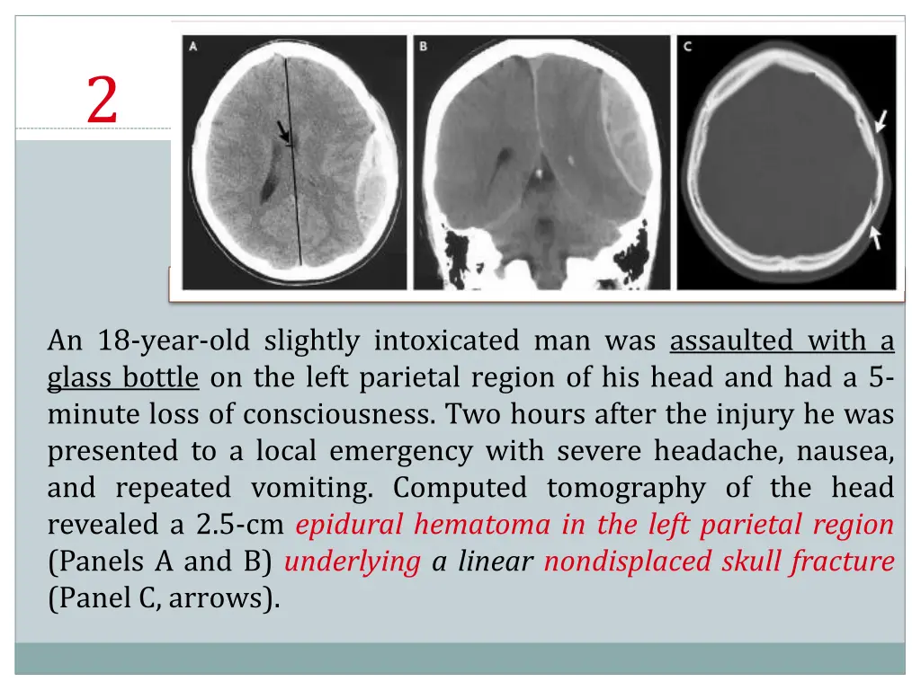 slide24