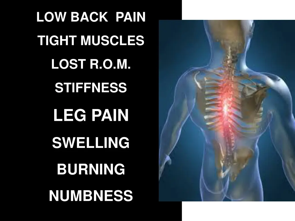 low back pain