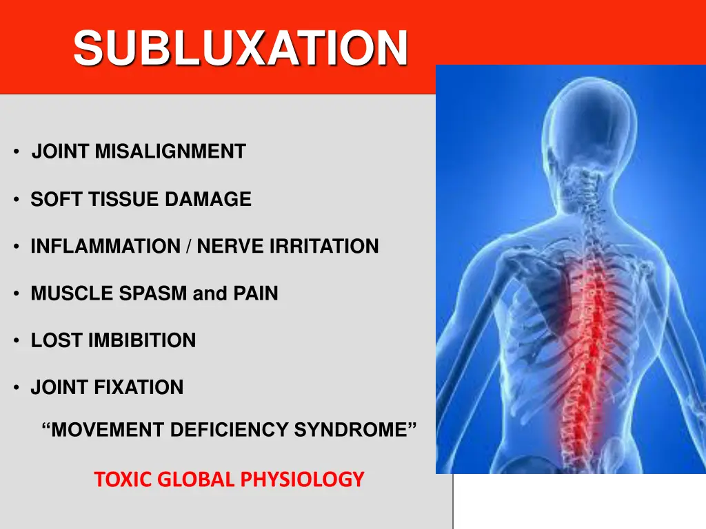 subluxation