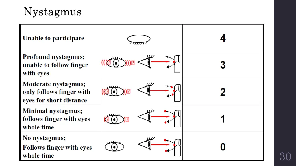 nystagmus