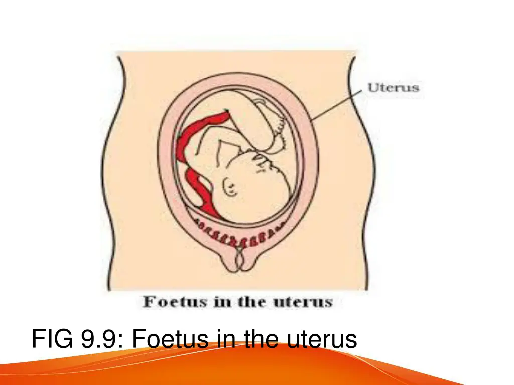 fig 9 9 foetus in the uterus