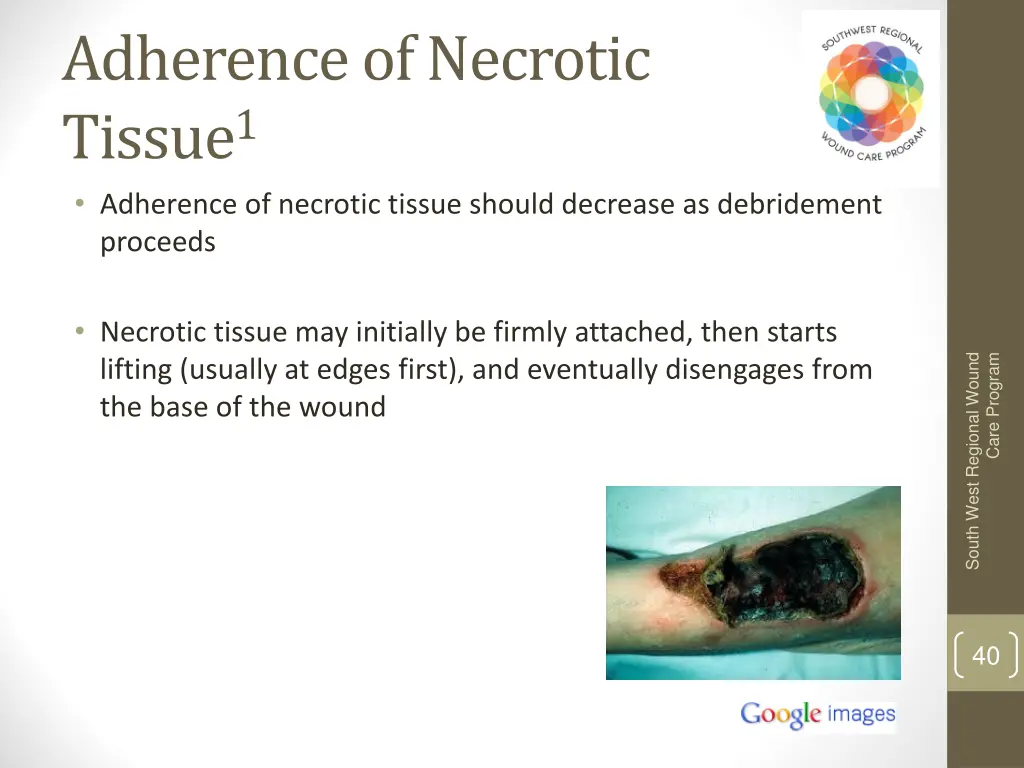 adherence of necrotic tissue 1 adherence