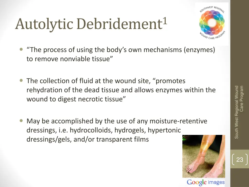 autolytic debridement 1