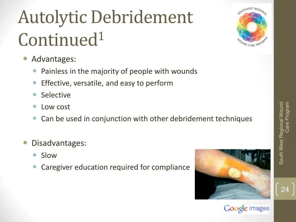 autolytic debridement continued 1 advantages