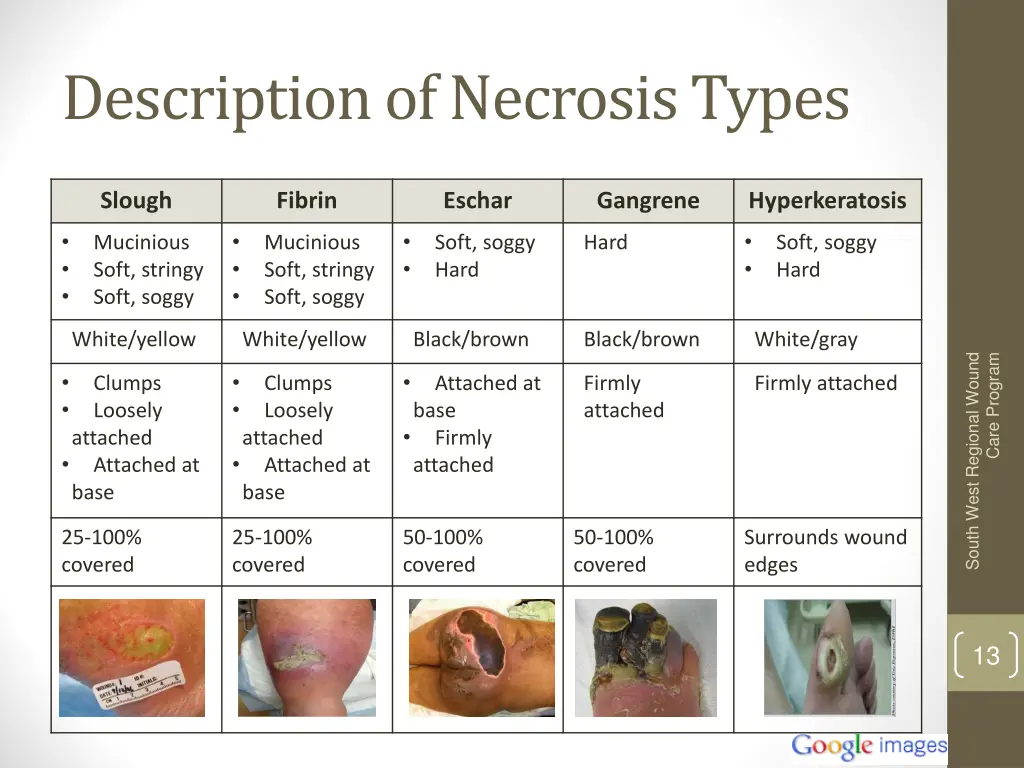 description of necrosis types