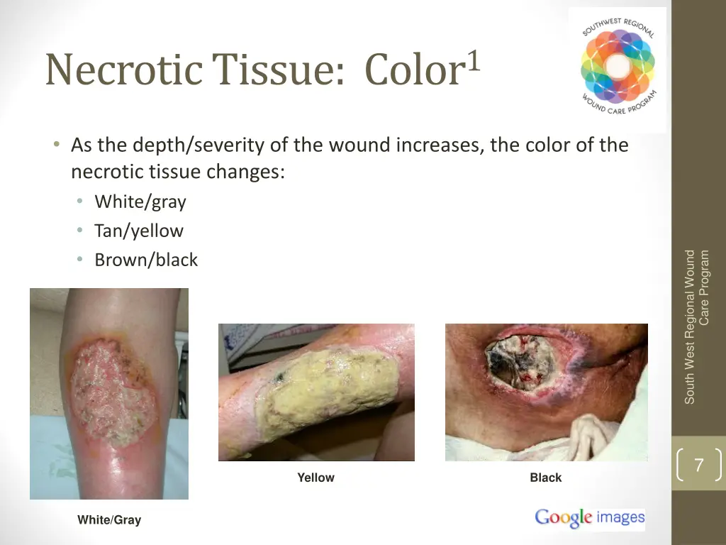 necrotic tissue color 1