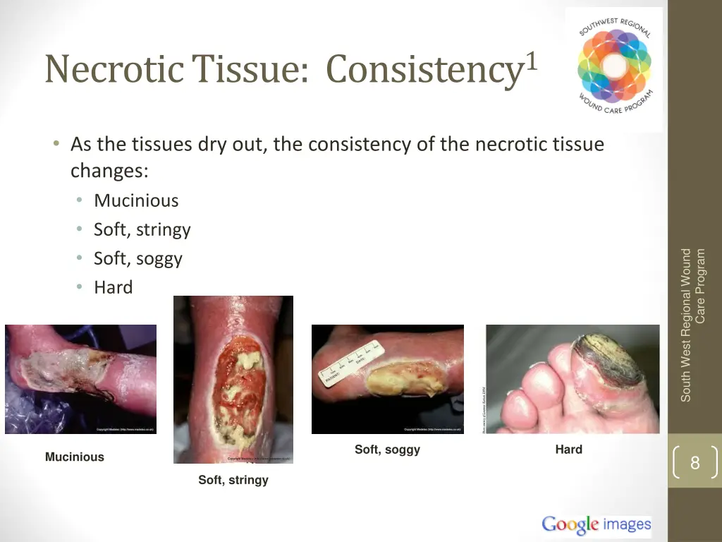 necrotic tissue consistency 1