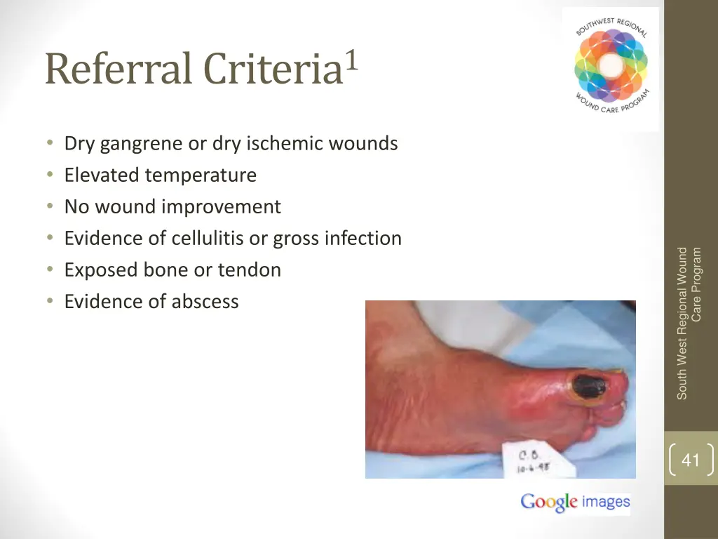 referral criteria 1