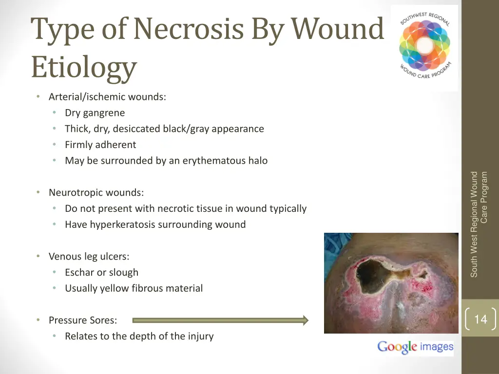 type of necrosis by wound etiology