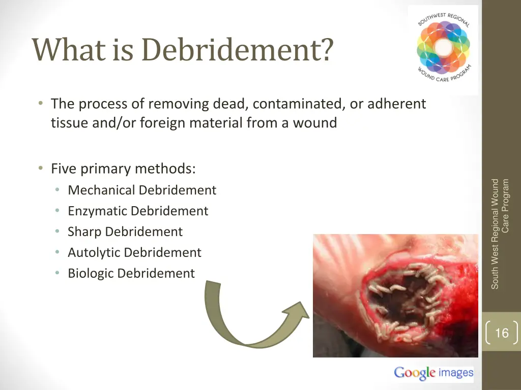 what is debridement