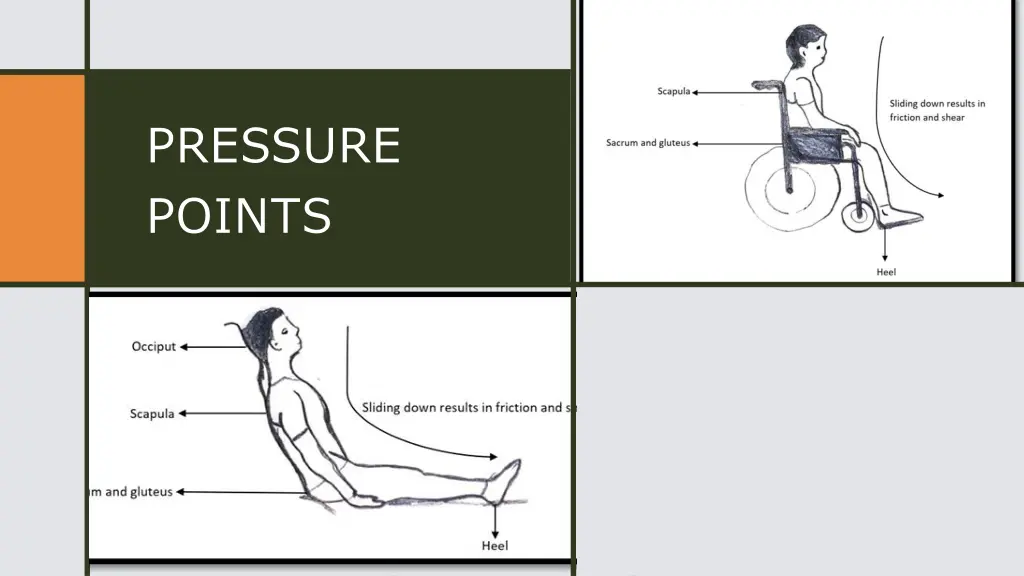 pressure points