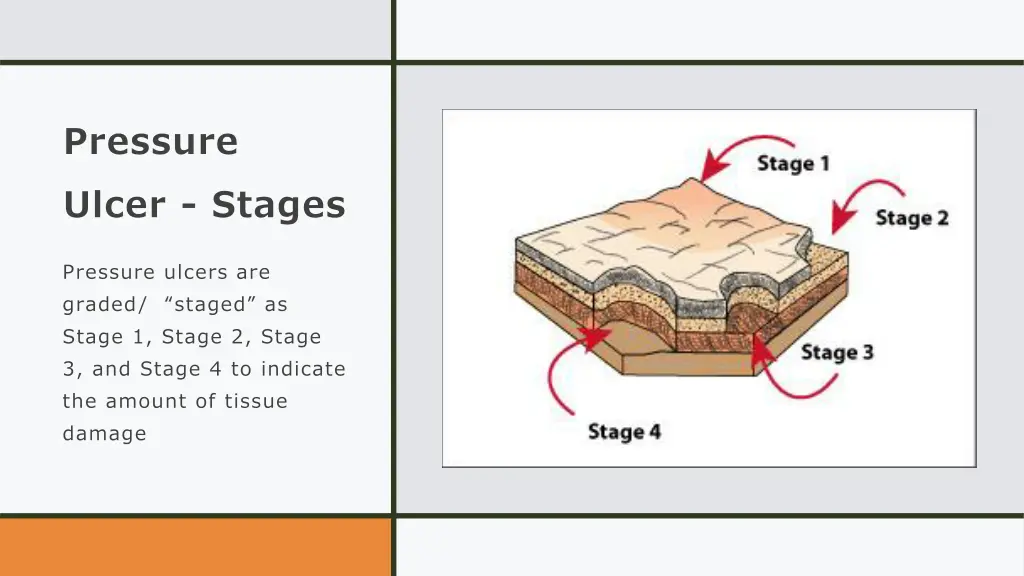 pressure ulcer stages