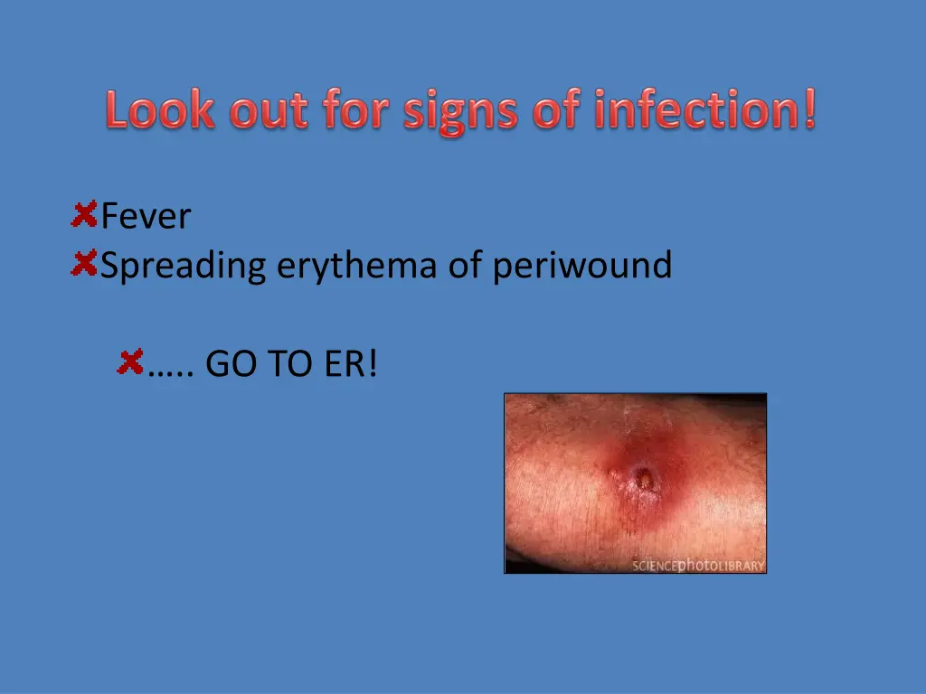 fever spreading erythema of periwound