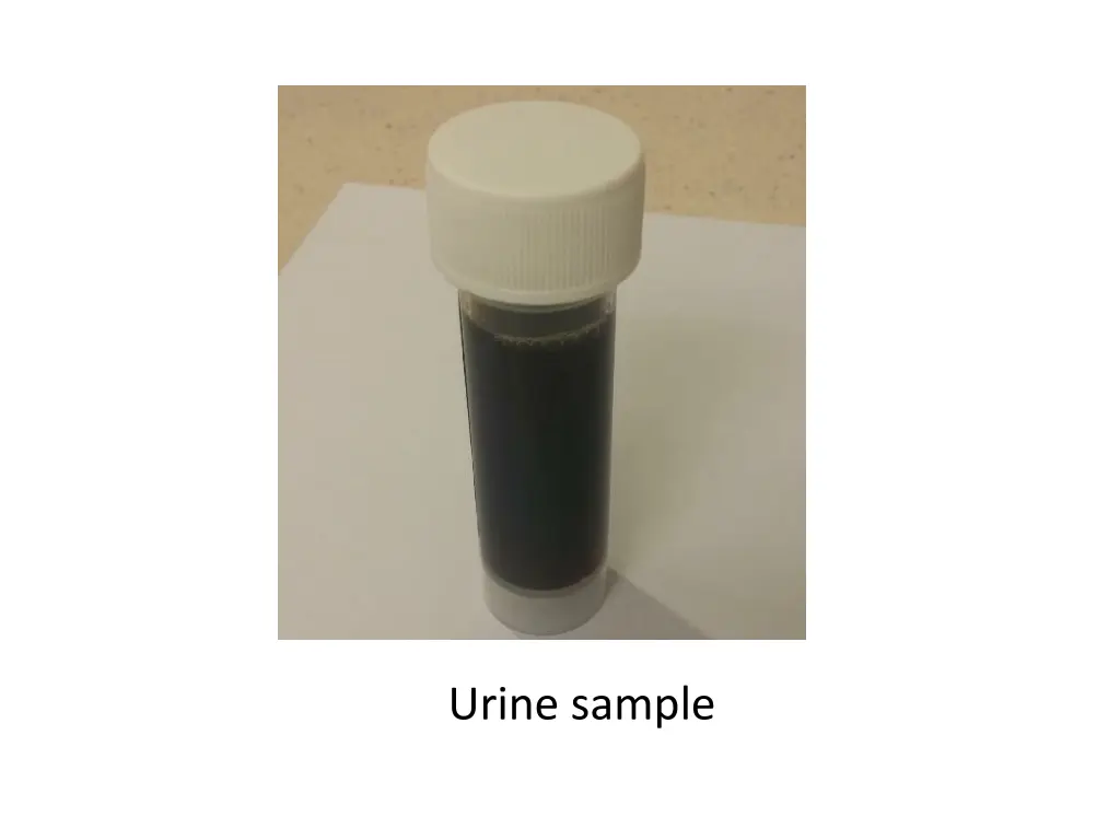 urine sample