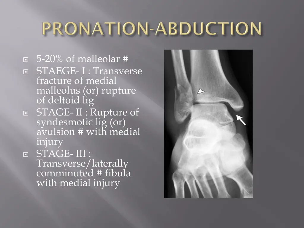 5 20 of malleolar staege i transverse fracture