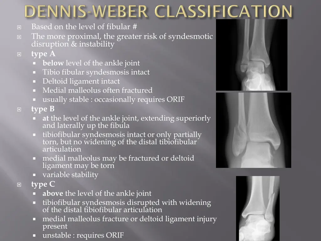 based on the level of fibular the more proximal