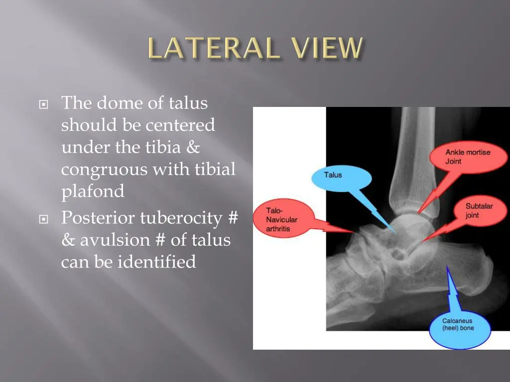 the dome of talus should be centered under