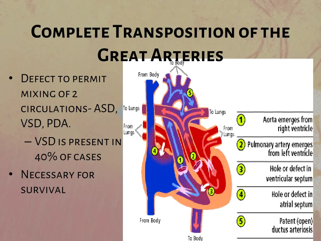 complete transposition of the great arteries 3